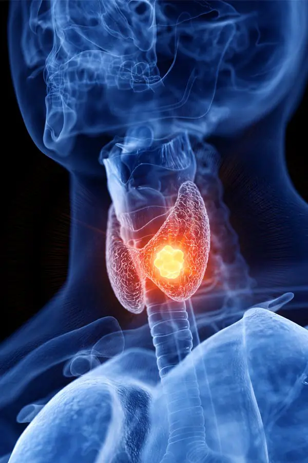A 3D illustration of an x-ray of a human neck, highlighting the thyroid. Get help with thyroid imbalance from Blue Skye Health and Wellness in Tampa.